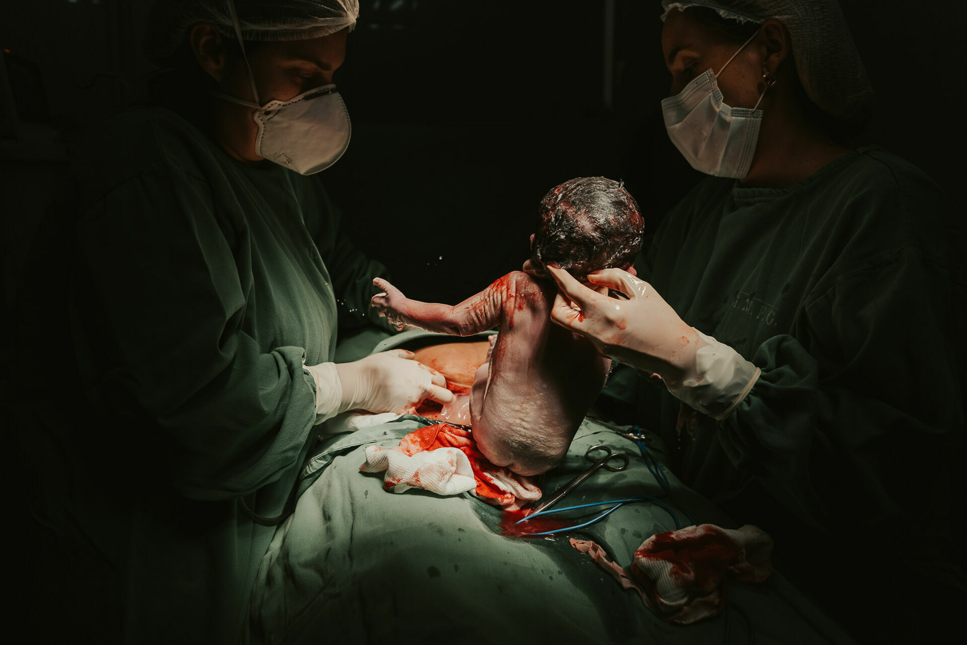 Foto Cesárea Intraparto no Hospital Frei Galvão em Guará - SP Foto Cesárea Intraparto no Hospital Frei Galvão em Guará - SP - Imagem 5