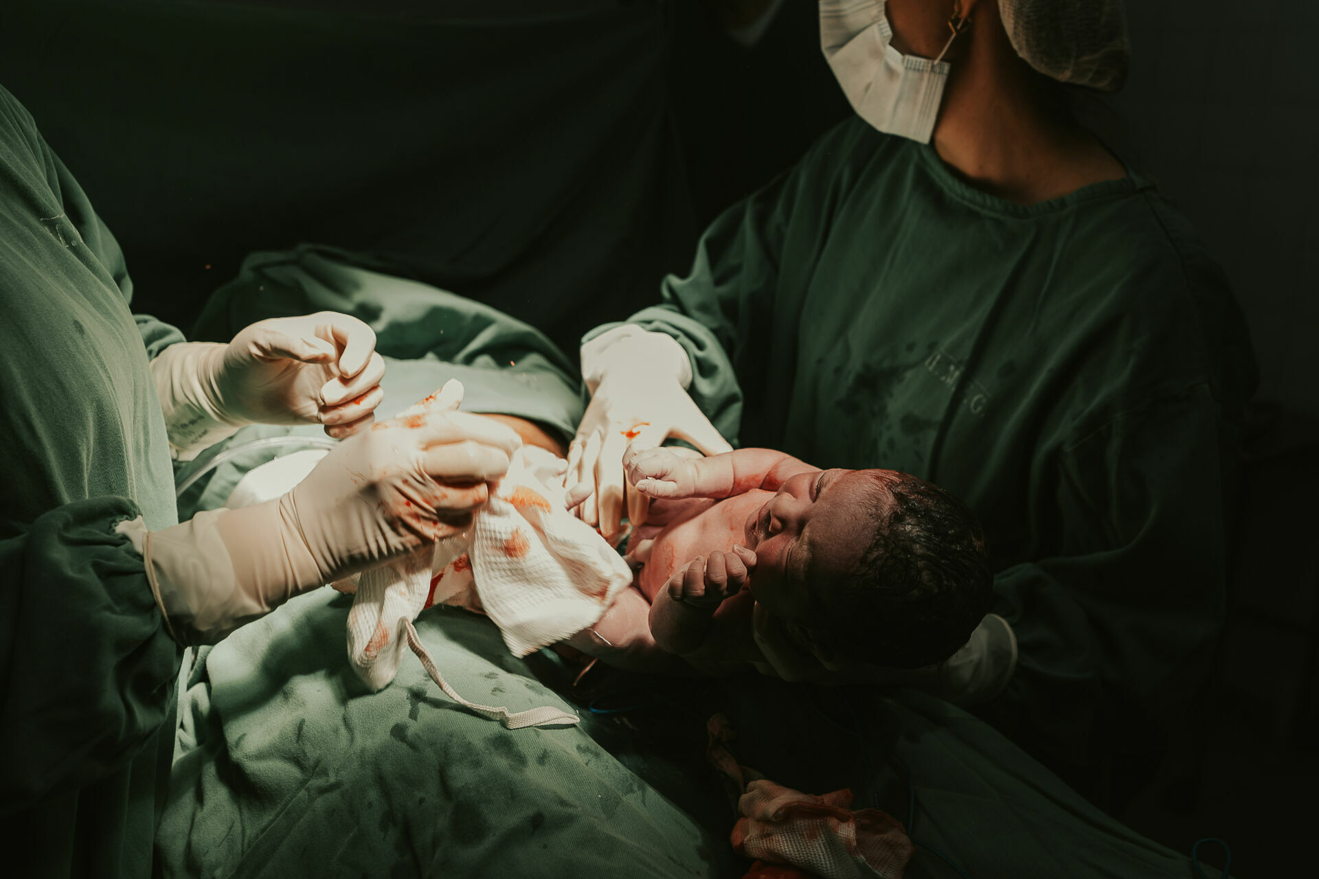 Foto Cesárea Intraparto no Hospital Frei Galvão em Guará - SP Foto Cesárea Intraparto no Hospital Frei Galvão em Guará - SP - Imagem 7