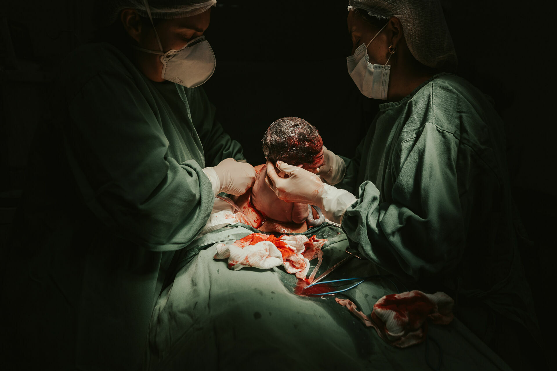 Foto Cesárea Intraparto no Hospital Frei Galvão em Guará - SP Foto Cesárea Intraparto no Hospital Frei Galvão em Guará - SP - Imagem 2