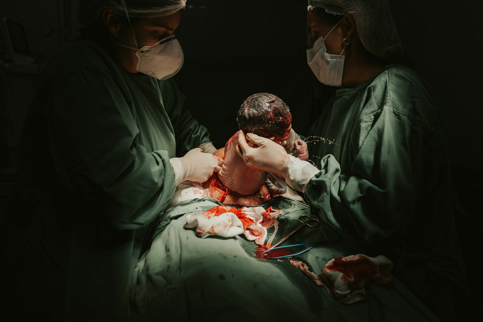 Foto Cesárea Intraparto no Hospital Frei Galvão em Guará - SP Foto Cesárea Intraparto no Hospital Frei Galvão em Guará - SP - Imagem 3
