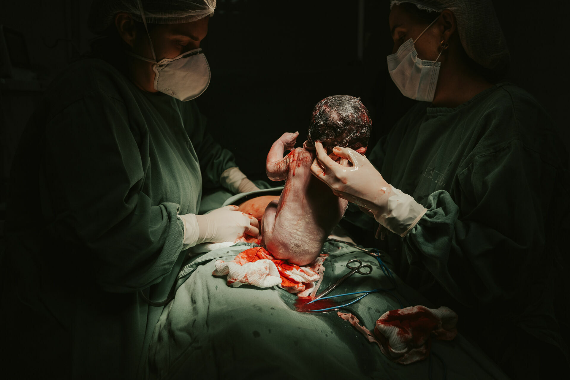 Foto Cesárea Intraparto no Hospital Frei Galvão em Guará - SP Foto Cesárea Intraparto no Hospital Frei Galvão em Guará - SP - Imagem 4