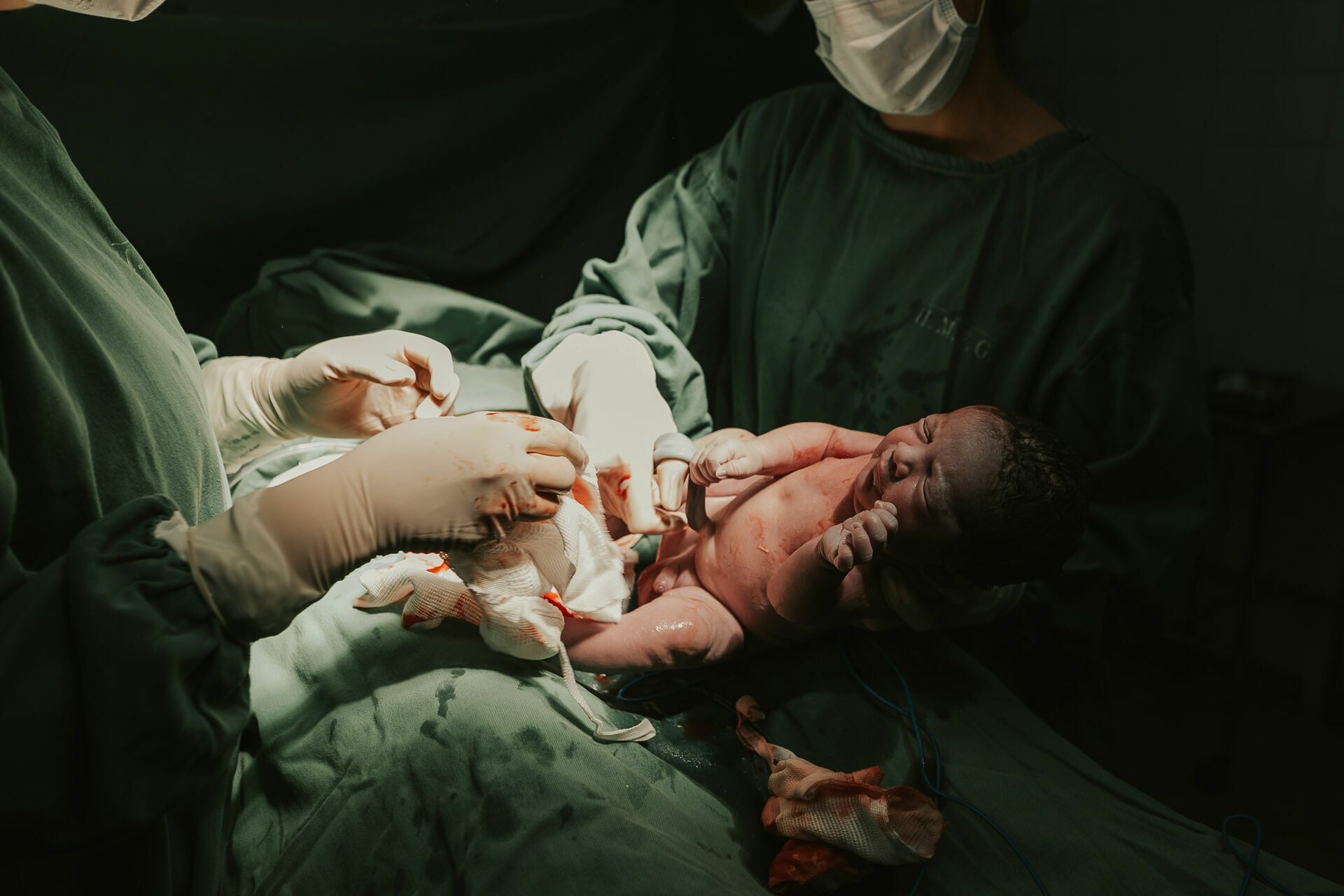 Foto Cesárea Intraparto no Hospital Frei Galvão em Guará - SP Foto Cesárea Intraparto no Hospital Frei Galvão em Guará - SP - Imagem 6