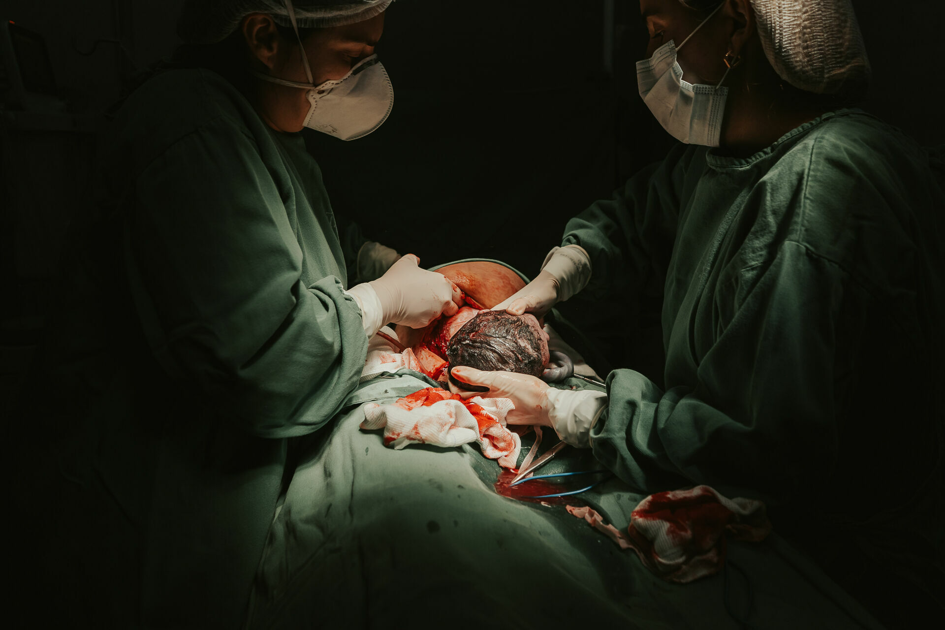 Foto Cesárea Intraparto no Hospital Frei Galvão em Guará - SP Foto Cesárea Intraparto no Hospital Frei Galvão em Guará - SP - Imagem 1