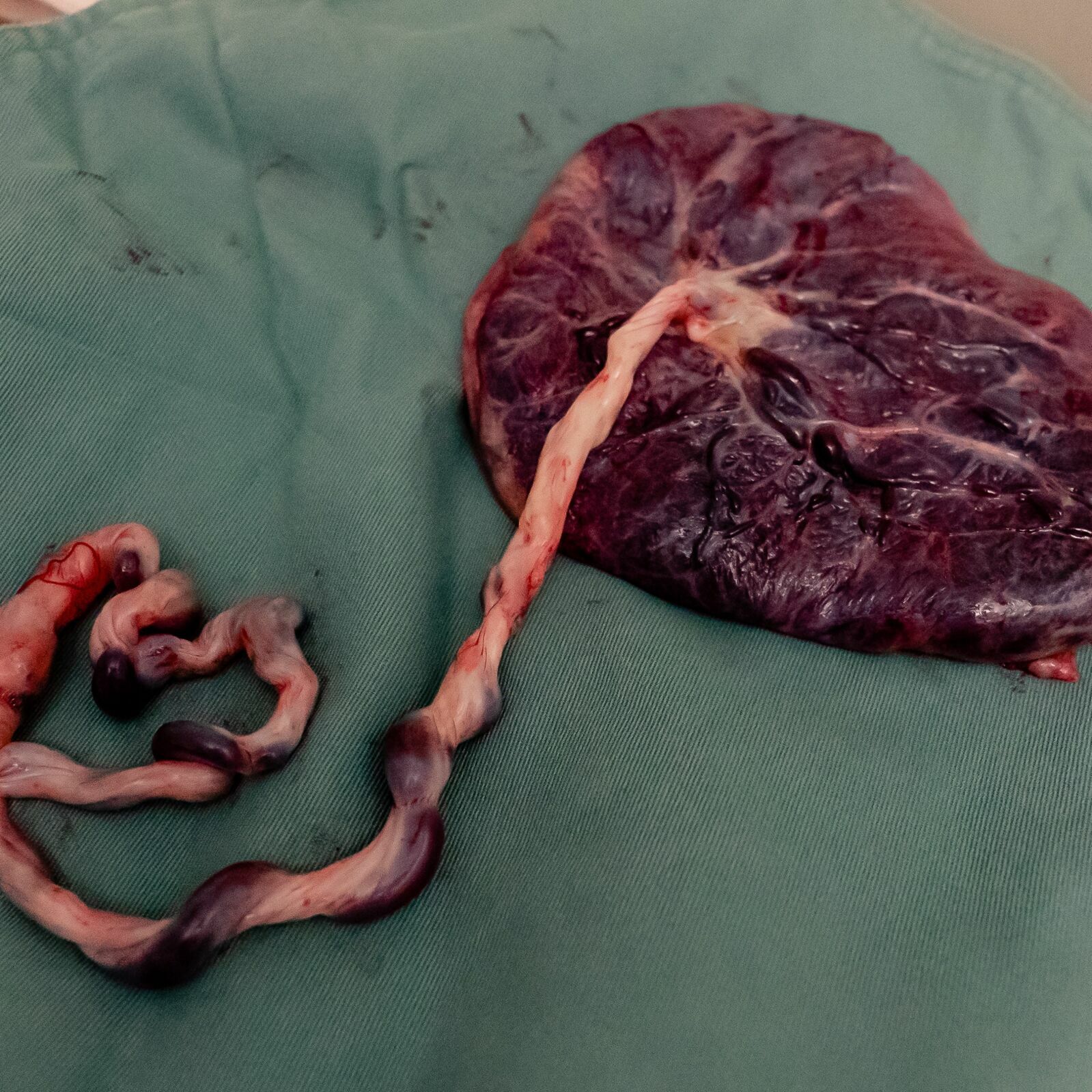 Foto A placenta por @doula_gramazzei Foto A placenta por @doula_gramazzei - Imagem 0